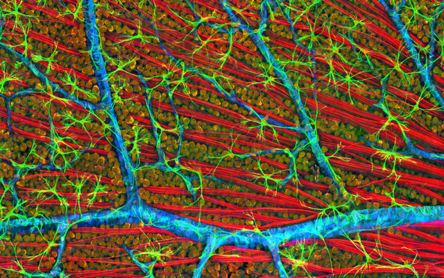 Using Crispr To Reverse Retinitis Pigmentosa And Restore Visual Function