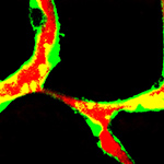 Cholesterol Sets Off Chaotic Blood Vessel Growth