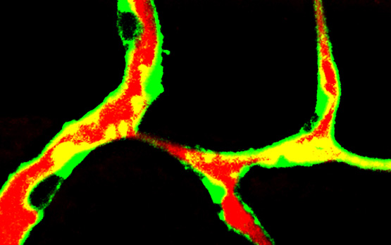 Cholesterol Sets Off Chaotic Blood Vessel Growth