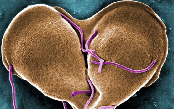 Enterobíase O que é causas tratamento e prevenção Parasite detox, Parasite clean
