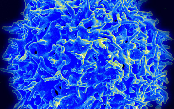 Using microRNA Fit to a T (cell)