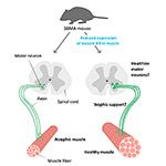 Mutant Protein in Muscle Linked to Neuromuscular Disorder