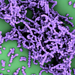 A Key Step Toward a Safer Strep Vaccine