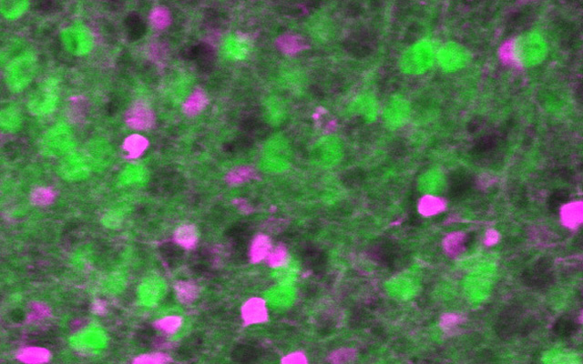 E/I Neurons