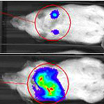 Enzyme Controlling Metastasis of Breast Cancer Identified