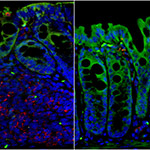 Scientists Discover Pain Receptor on T-Cells