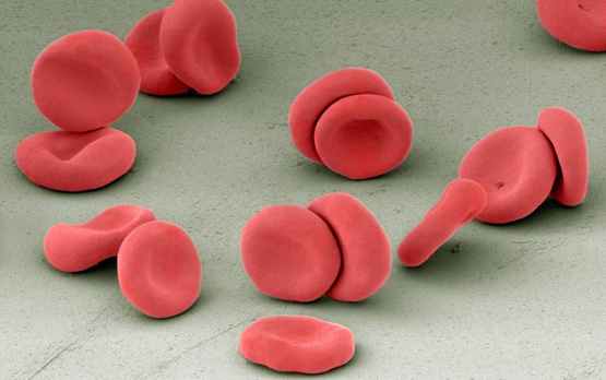 scanning electron micrograph of red blood cells