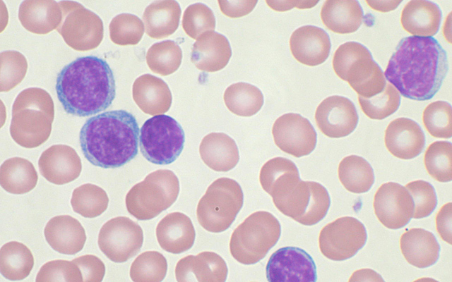 Protein-Protein Interaction Activates and Fuels Leukemia Cell Growth