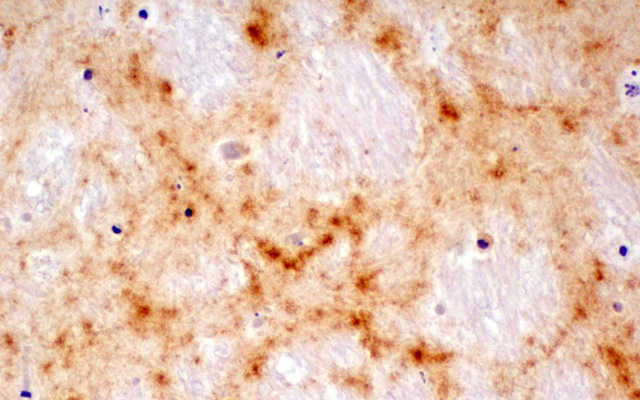 Small Loop in Human Prion Protein Prevents Chronic Wasting Disease