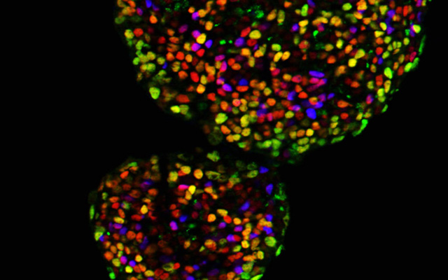 “Open” Stem Cell Chromosomes Reveal New Possibilities for Diabetes