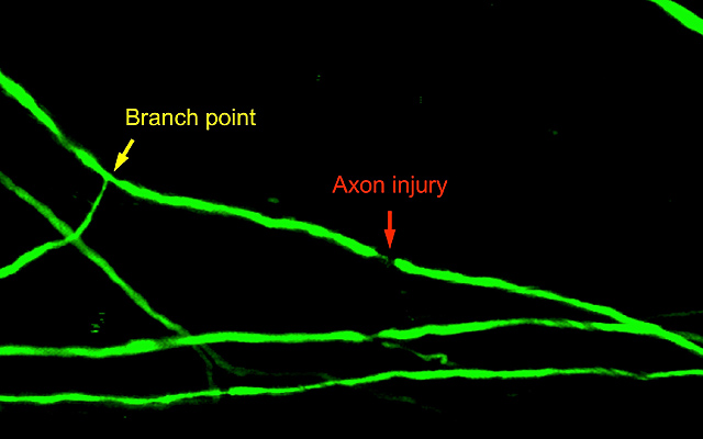 Spinal Cord Axon Injury Location Determines Neuron’s Regenerative Fate