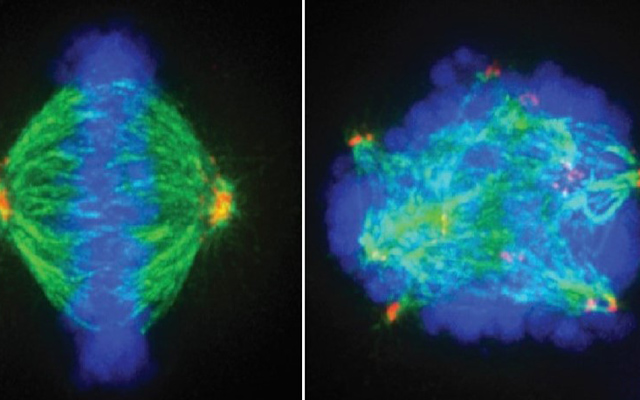 New Combination Treatment Strategy to “Checkmate” Glioblastoma