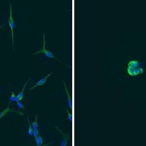 Epigenetic Driver of Glioblastoma Provides New Therapeutic Target