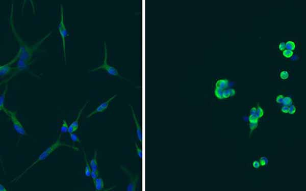 Image: Non-tumorigenic glioblastoma cells