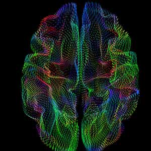 A New Wrinkle: Geometry of Brain’s Outer Surface Correlates With Genetic Heritage