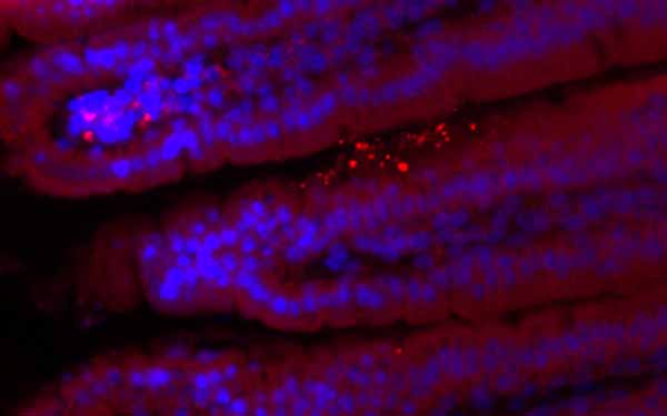 Image: Mice lacking REG3G had more bacteria (bright spots) in their gut linings.