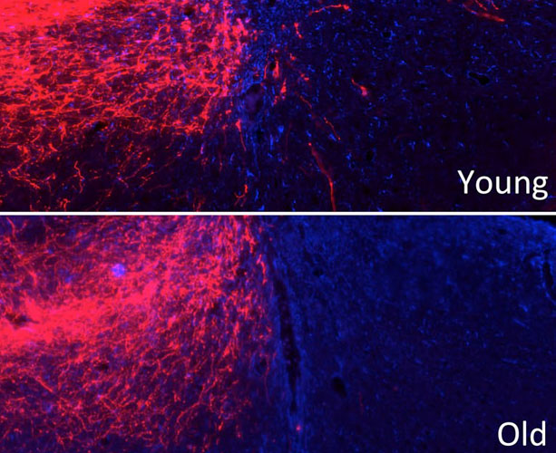 Image: Deletion of the Pten gene promotes axon regeneration in young but not old mice after spinal cord injury