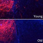 Aging Diminishes Spinal Cord Regeneration After Injury