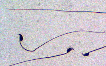 图片:在实验小鼠中，研究人员发现，当NMD抑制因子UPF3A在产生精子的细胞中被阻止表达时，精子产量会急剧下降。