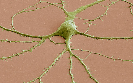 Image: False-colored scanning electron micrograph of a human neuron