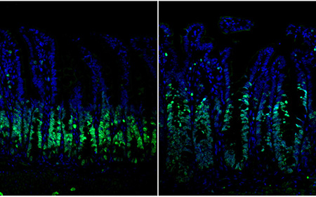 Image: Immunofluorescent staining of intestinal epithelium tissue shows cell growth (green)