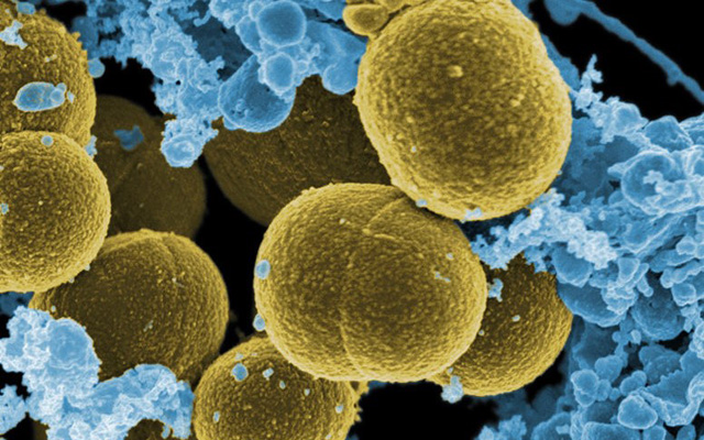 Staphylococcus aureus photo.