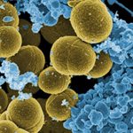 Distinguishing Deadly Staph Bacteria from Harmless Strains