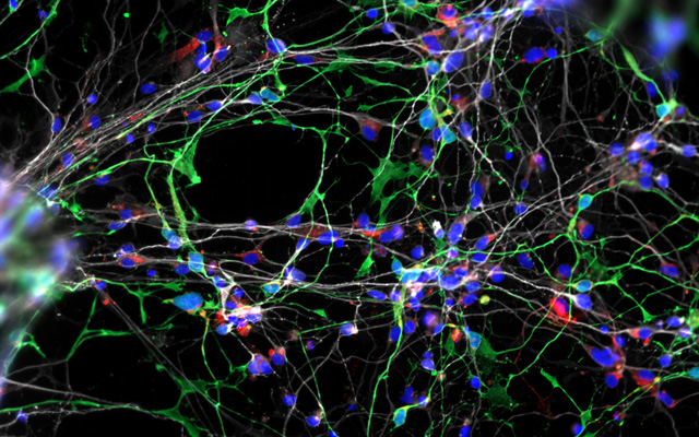 Neurodevelopmental Model of Williams Syndrome Offers Insight into Human Social Brain