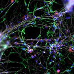 Neurodevelopmental Model of Williams Syndrome Offers Insight into Human Social Brain