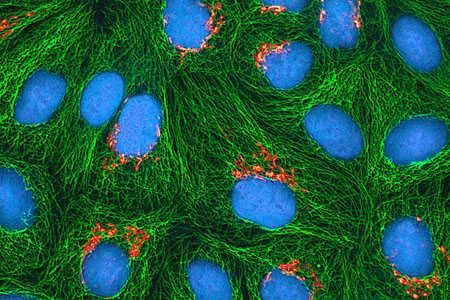 Cultured HeLa cancer cells