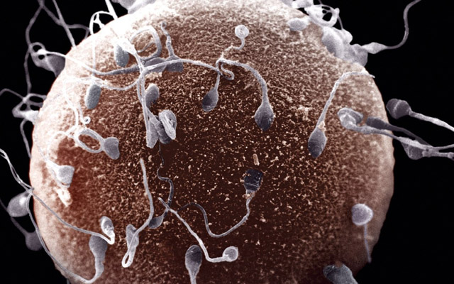 Researchers Find Fertility Genes Required for Sperm Stem Cells