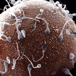 Researchers Find Fertility Genes Required for Sperm Stem Cells