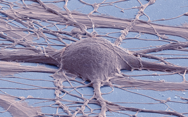 Created Line of Spinal Cord Neural Stem Cells Shows Diverse Promise