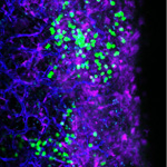 Antibody Breaks Leukemia’s Hold, Providing New Therapeutic Approach