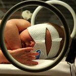 Severe Newborn Jaundice Could be Preventable, Mouse Study Shows