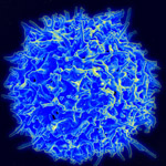 CIRM Approves $5.8 Million Grant for CAR-T Therapy that Targets Cancer Stem Cells