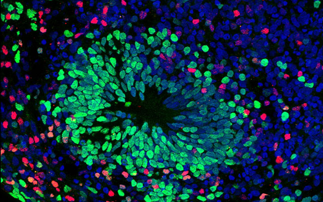 Organoids are clusters of cultured cells self-organized into miniature replicas of organs