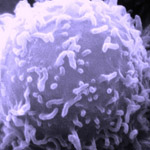 State’s Stem Cell Agency Awards $18.2 Million Grant for B Cell Cancer Clinical Trial