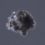 Editing Genes One by One Throughout Colorectal Cancer Cell Genome Uncovers New Drug Targets