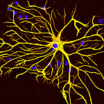 Inflamed Support Cells Appear to Contribute to Some Kinds of Autism