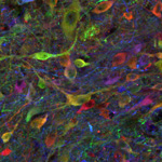 Reprogrammed Stem Cell-Derived Neurons Survive Long-Term in Pigs with Spinal Cord Injuries