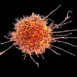 CAR-T Immunotherapies May Have a New Player