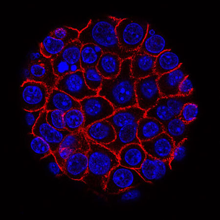 pancreatic cancer cells