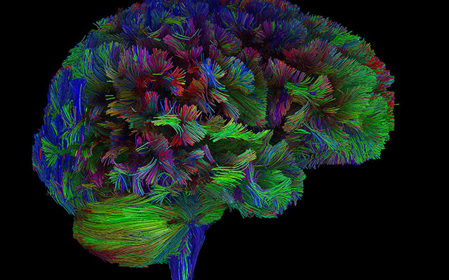 With Landmark Gift, UC San Diego Will Map Compassion in the Brain, then Prove its Power