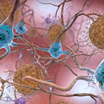 Researchers Map Protein-Gene Interactions Involved in Alzheimer’s Disease