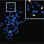 Non-Coding DNA Located Outside Chromosomes May Help Drive Glioblastoma