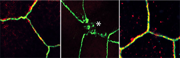 metformin acting on gut organoid