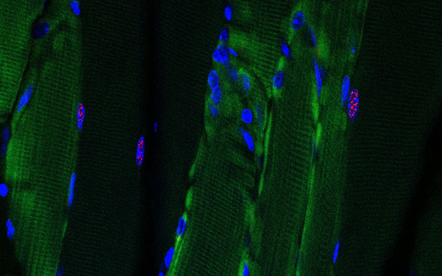 Twist on CRISPR Gene Editing Treats Adult-Onset Muscular Dystrophy in Mice