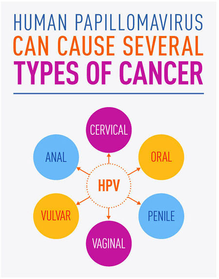 HPV infographic