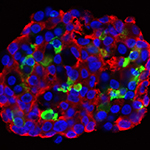 $6M NIH Grant Launches UC San Diego Consortium to Study Insulin-Producing Cells